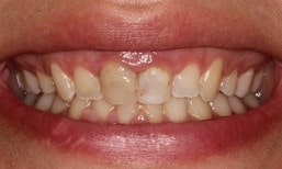 اصلاح طرح لبخند به رفع چه مشکلاتی می‌پردازد؟