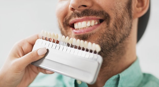 افراد مناسب برای استفاده از لمینت سرامیکی