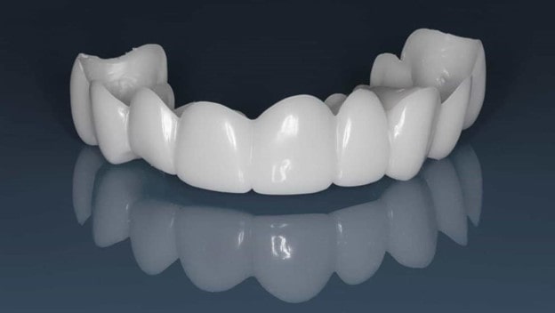 لمینت متحرک دندان چیست؟