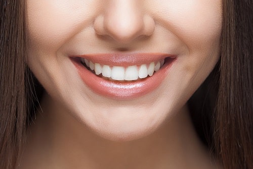 مزایای اصلاح طرح لبخند
