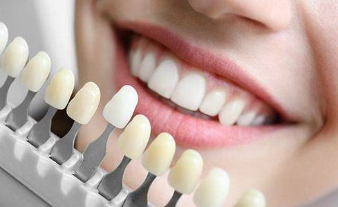 کامپوزیت ونیر چیست؟