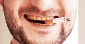 تاثیر سیگار بر دندان ها