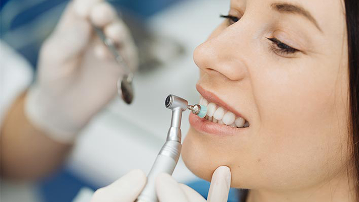 جرم-گیری-دندان-مرکز-دندانپزشکی-گیشا-آرام