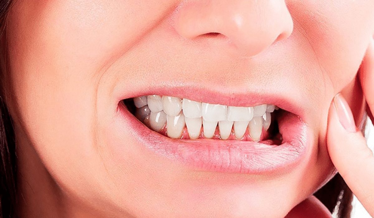 دندان قروچه - مرکز دندانپزشکی گیشا آرام