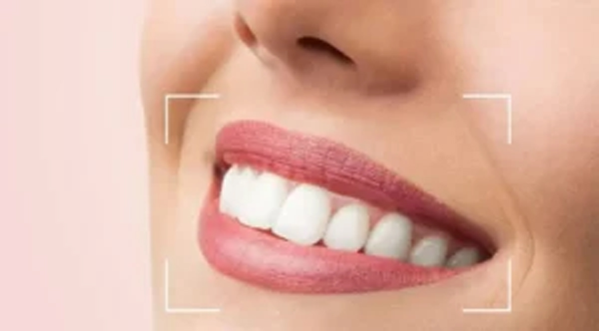طراحی لبخند-آرام دنتال