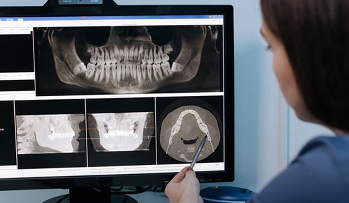متخصص عصب کشی-مرکز دندانپشکی آرام