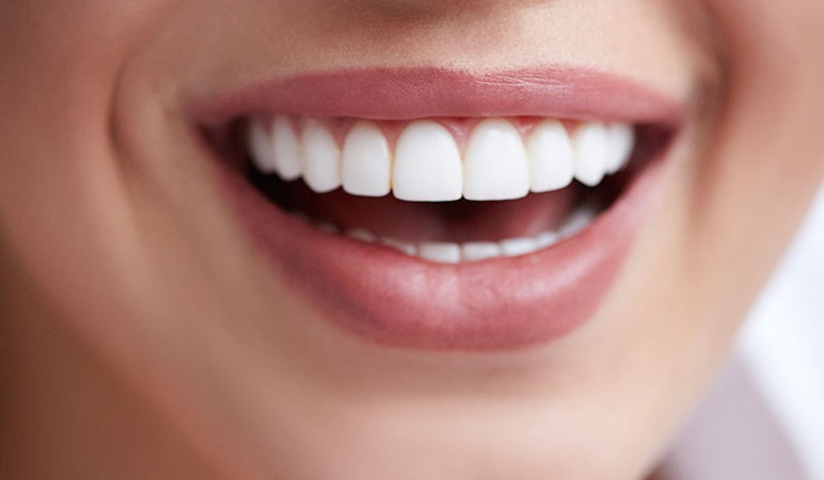 کامپوزیت دندانی -مرکز دندانپزشکی گیشا آرام