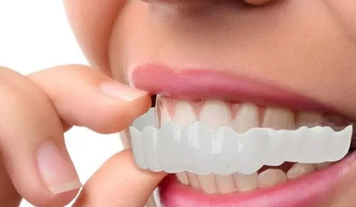 اسنپ اسمایل-مرکز دندانپزشکی گیشا آرام