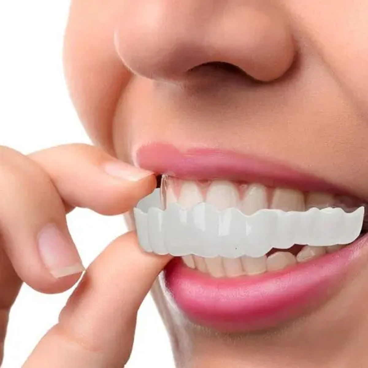 اسنپ اسمایل-مرکز دندانپزشکی گیشا آرام