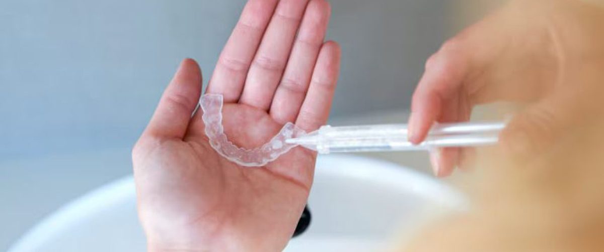 بلیچینگ خانگی- مرکز دندانپزشکی گیشا آرام