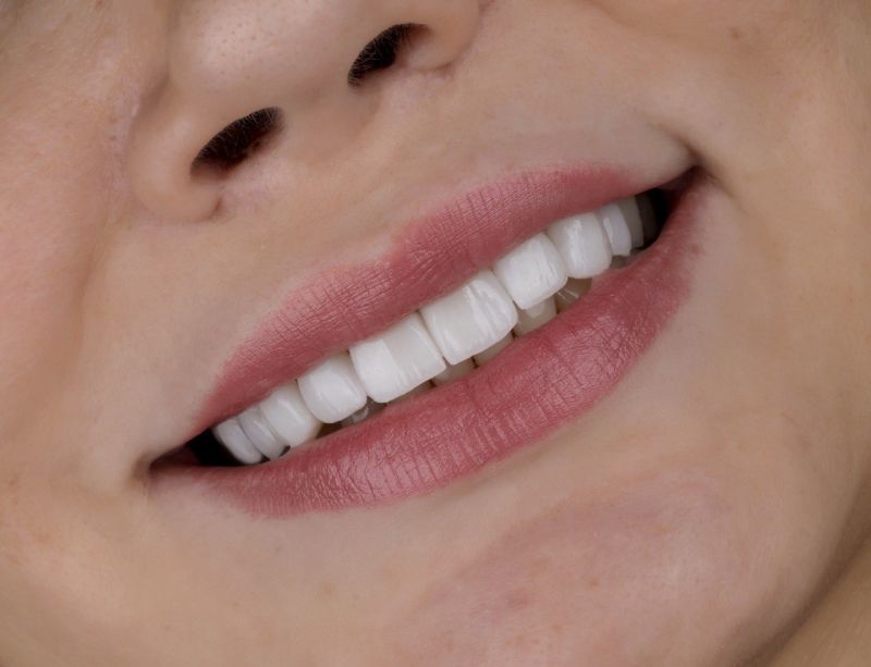 طراحی لبخند دندانپزشکی گیشا آرام