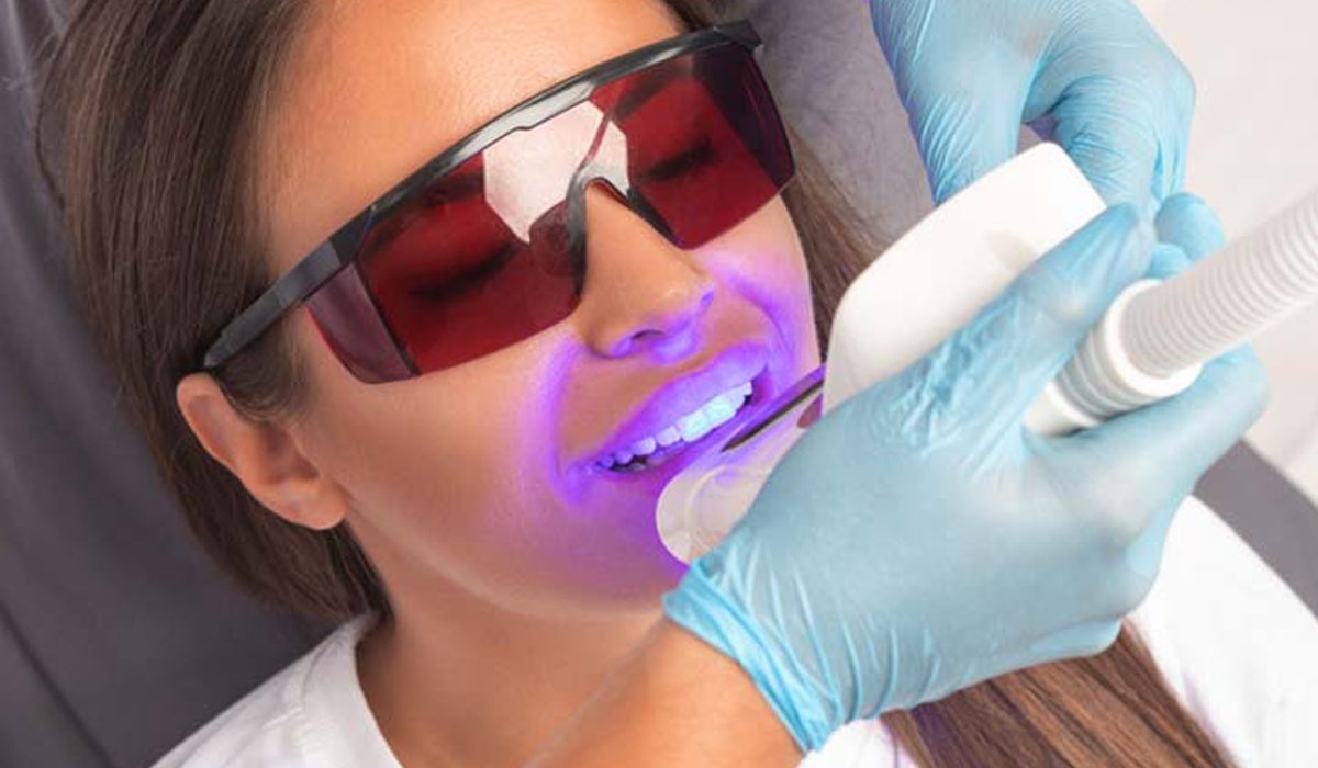 بلیچینگ دندان درد دارد- مرکز دندانپزشکی گیشا آرام دنتال