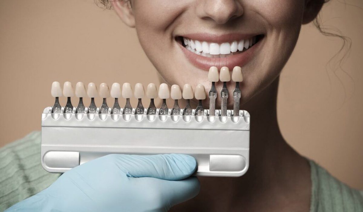 عوارض بلیچینگ دندان- مرکز دندانپزشکی گیشا آرام دنتال