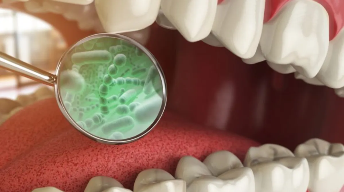 علت بوی بد دهان- دندانپزشکی گیشا آرام دنتال