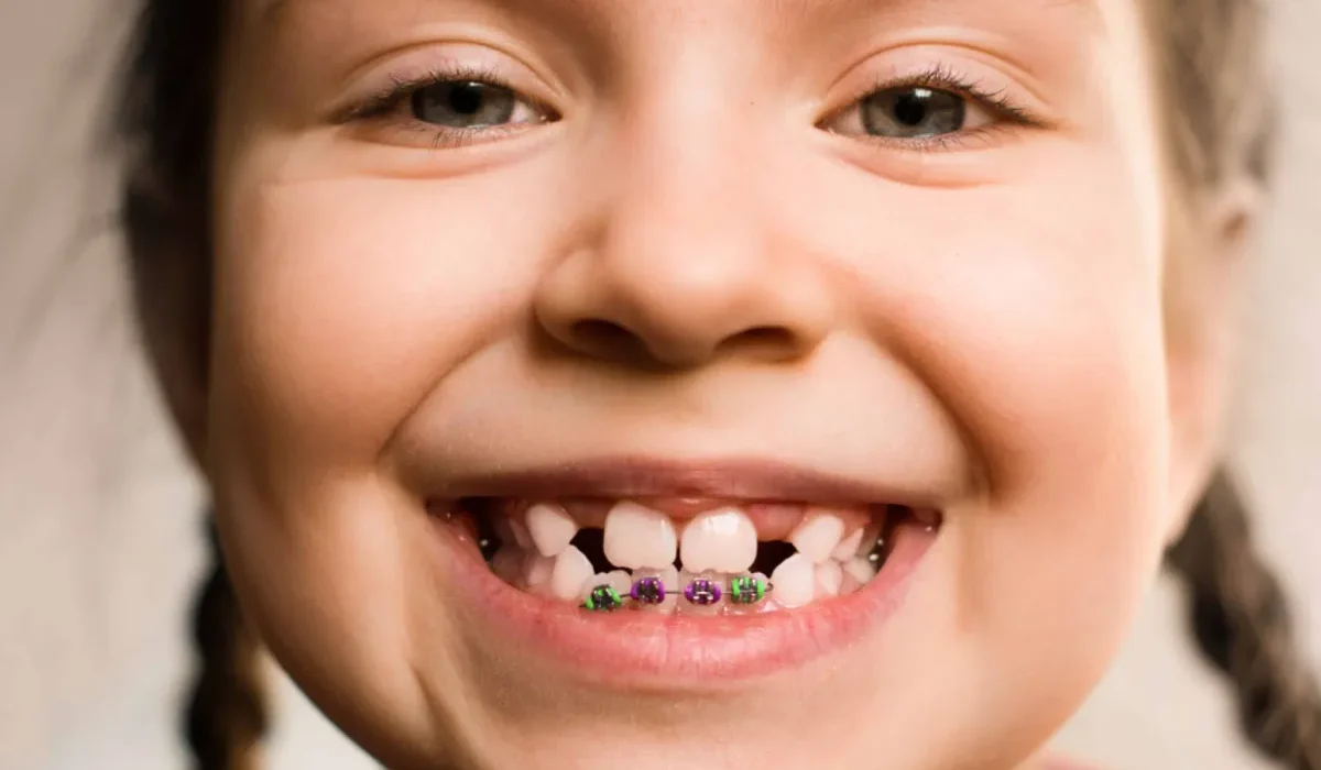 دندان شیری کودک- دندانپزشکی گیشا آرام دنتال